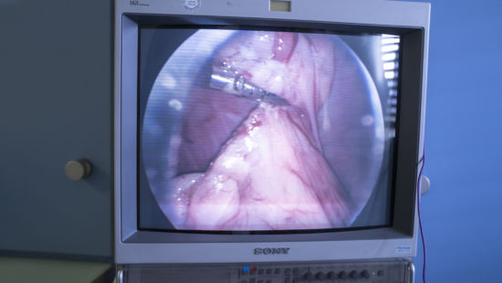 Chirurgie-Hofmann_Endoskopie_Chirurgie_302019_04.-Februar-2019